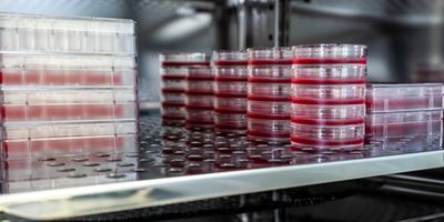 Cell culture dishes in an incubator