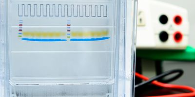 Gel separation of complex protein mixtures aids subsequent identification of individual proteins and can now be used in sequencing library prep workflows.