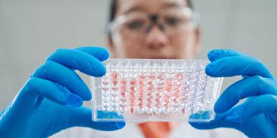 Low angle view of female scientist holding tray of medical samples in laboratory