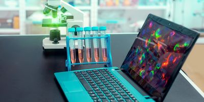 A microscope, a rack of fulcan tubes, and a laptop with a microscope image on the screen, on a table in a lab