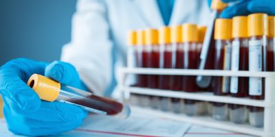 Scientist places blood samples in holder