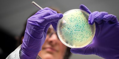 a pair of hands wearing purple gloves holding a bacterial culture in a petri dish containing clear yellowish gel and blue spots. a female scientist's face is partially visible in the background.