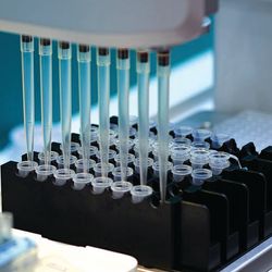 The pipette tips of an automatic liquid handler put samples into a black tray of tubes in a robotic lab workstation.