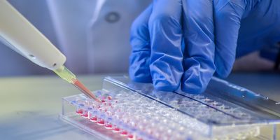 Scientist pipettes into a microplate