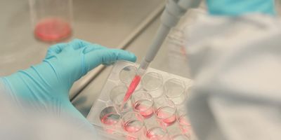 Scientist pipettes into a microplate