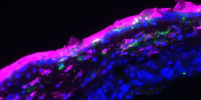 Microscope image of skin showing the aptamers (here marked in pink) were applied to the top layer of the skin in the form of an ointment and also penetrate into the deeper dermal layers (nucleus: blue; antigen-presenting cells: green). 