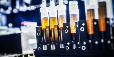 separated blood samples in a black tube rack in a laboratory, yellow and red liquid in clear tubes