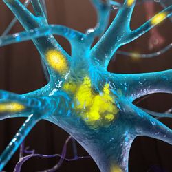 Advanced Cell Models Enable Neurodegenerative Disease Research