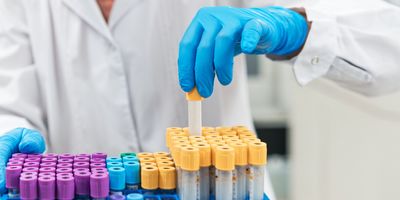 Gloved female scientist pulling removing one medical sample tube from a lab rack