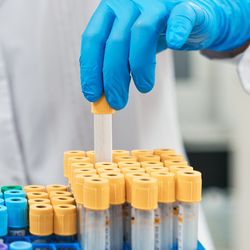 Gloved female scientist pulling removing one medical sample tube from a lab rack