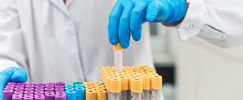 A gloved female hand removing a test tube from a lab rack