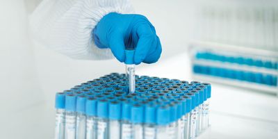 The hand of a young Asian woman holding a test tube in a lab