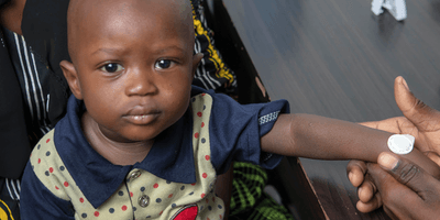 A young Gambian child sits on someone's lap looking at the camera while a circular white microarray patch is applied to his wrist