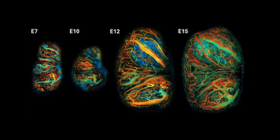 3d image showing a mouse placenta on day 8, day 10, day 12, and day 15 of development. The blood vessels are shown in yellow, blue, green, and red, and their diameter and density increase in each subsequent image