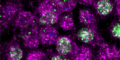 Image showing cells after UV exposure, mostly pink with some green, where ribosomes activation is shown in pink and the DNA-initiated response is shown in green